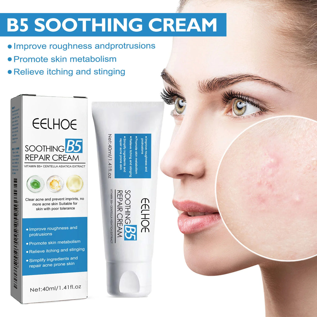 Eelhoe B5 Repair Cream – Soothing Hydrating Face Moisturizer Face Repair Cream Zpaxo