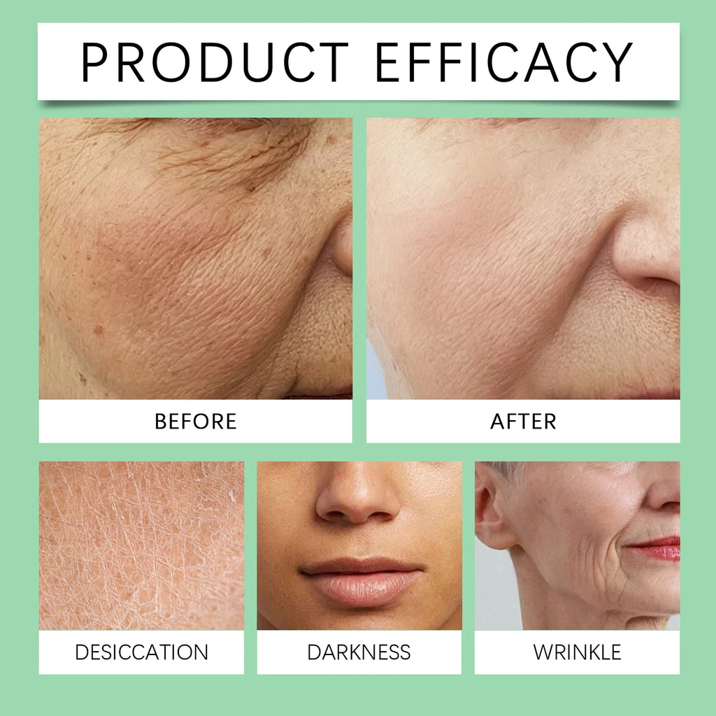 Invisible Facial Lifting Patches Set for Face Contouring Skin Tightening moisturizing Holiday Gift Winter Skincare Daily Care Zpaxo