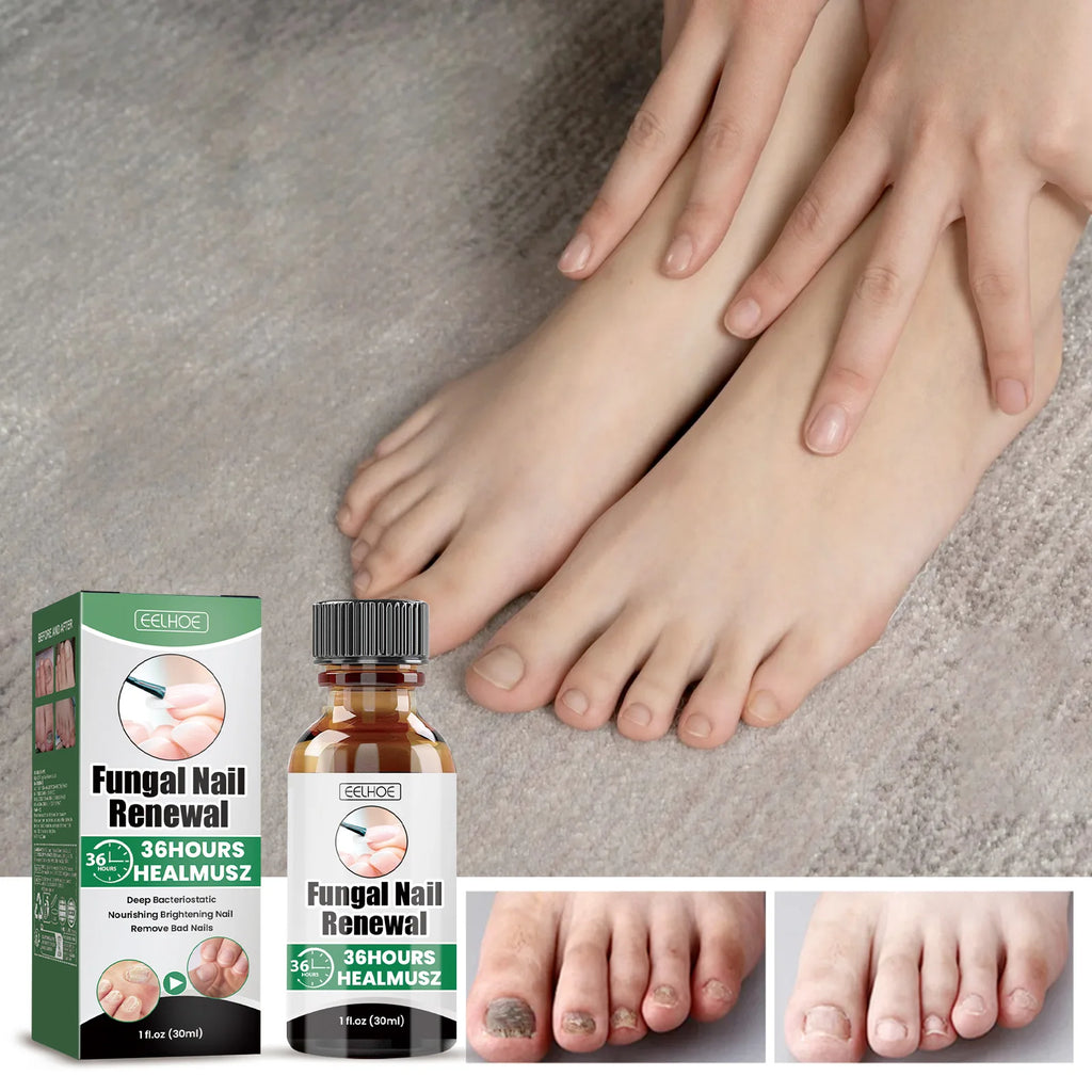 Nail Repair & Strengthening LiquidRepairs and nourishes nails, brightens, moisturizes and protects, for hand & foot nail care. Zpaxo