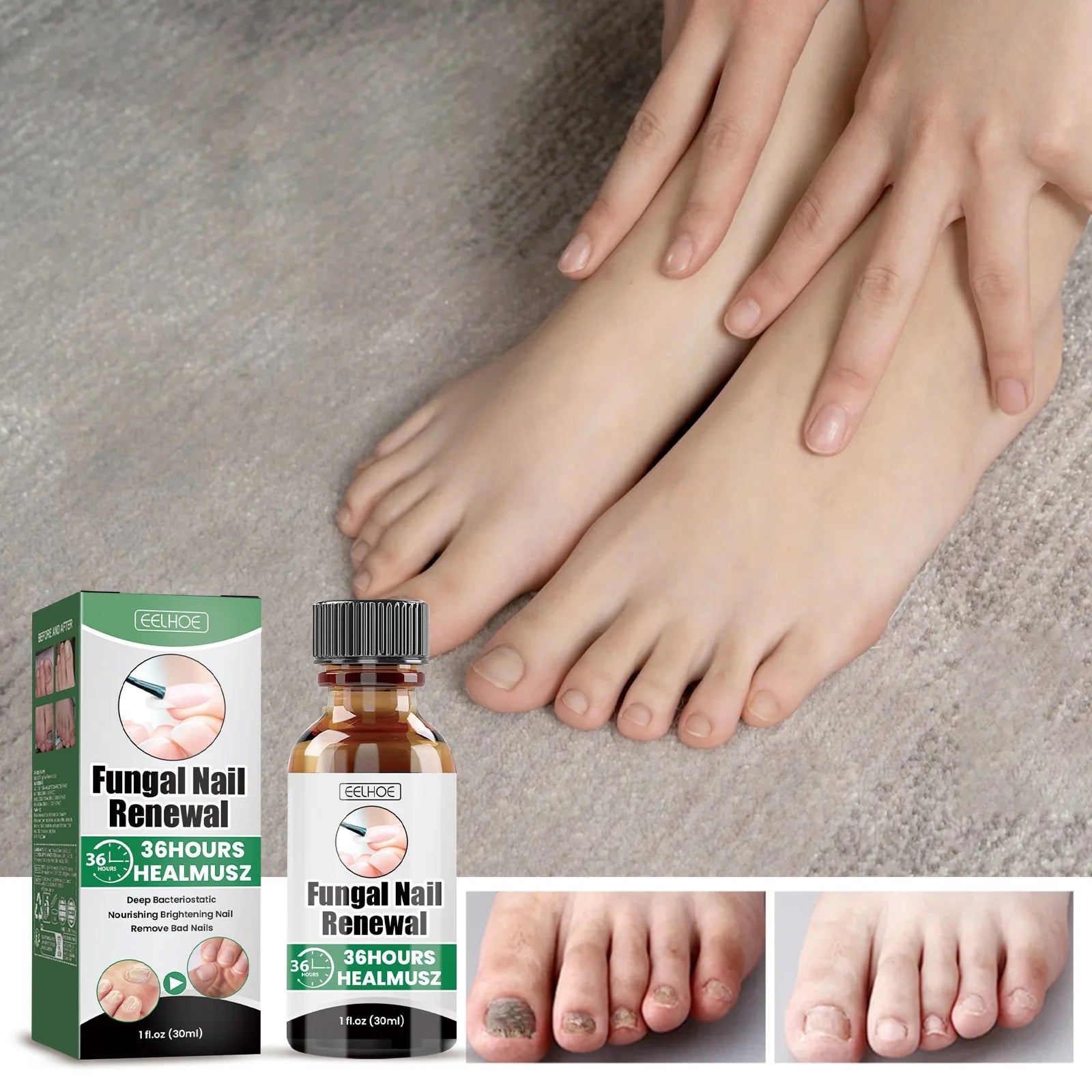 Nail Repair & Strengthening LiquidRepairs and nourishes nails, brightens, moisturizes and protects, for hand & foot nail care. Zpaxo