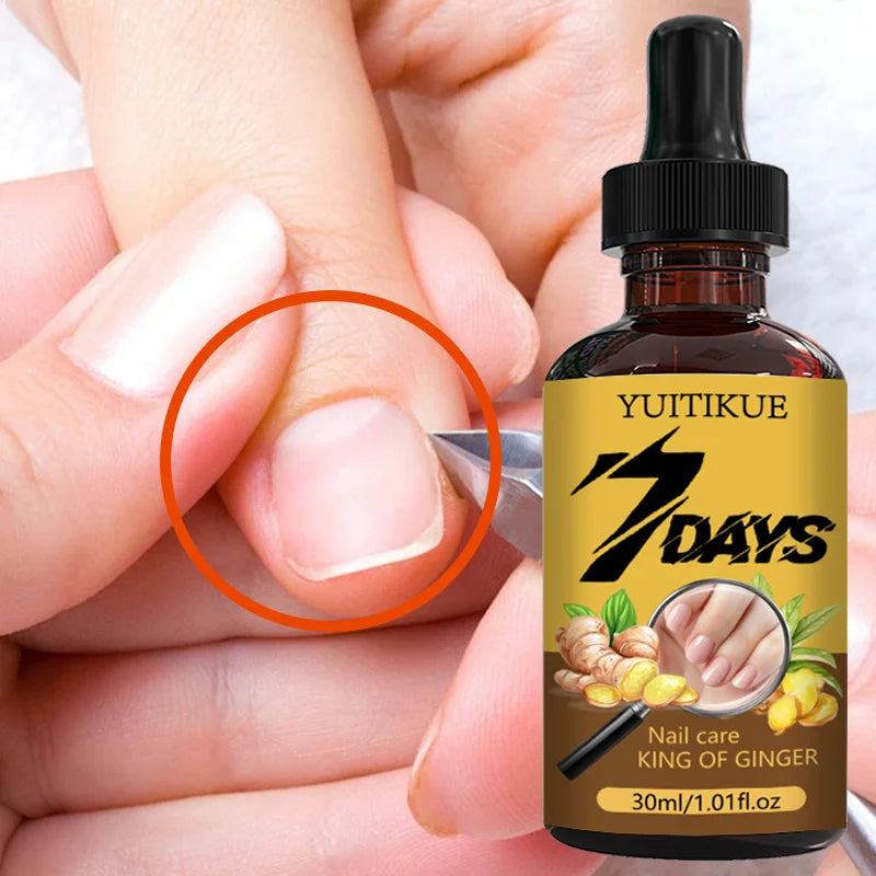 YUITIKUE 7-Day Ginger Nail Care Oil – Nourish & Strengthen 30ml Nail Treatment Oil Zpaxo
