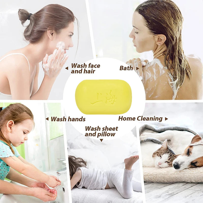Shanghai Sulfur Soap – Oil Control & Acne Cleanser 3/5 Pack Sulfur Cleansing Soap Zpaxo