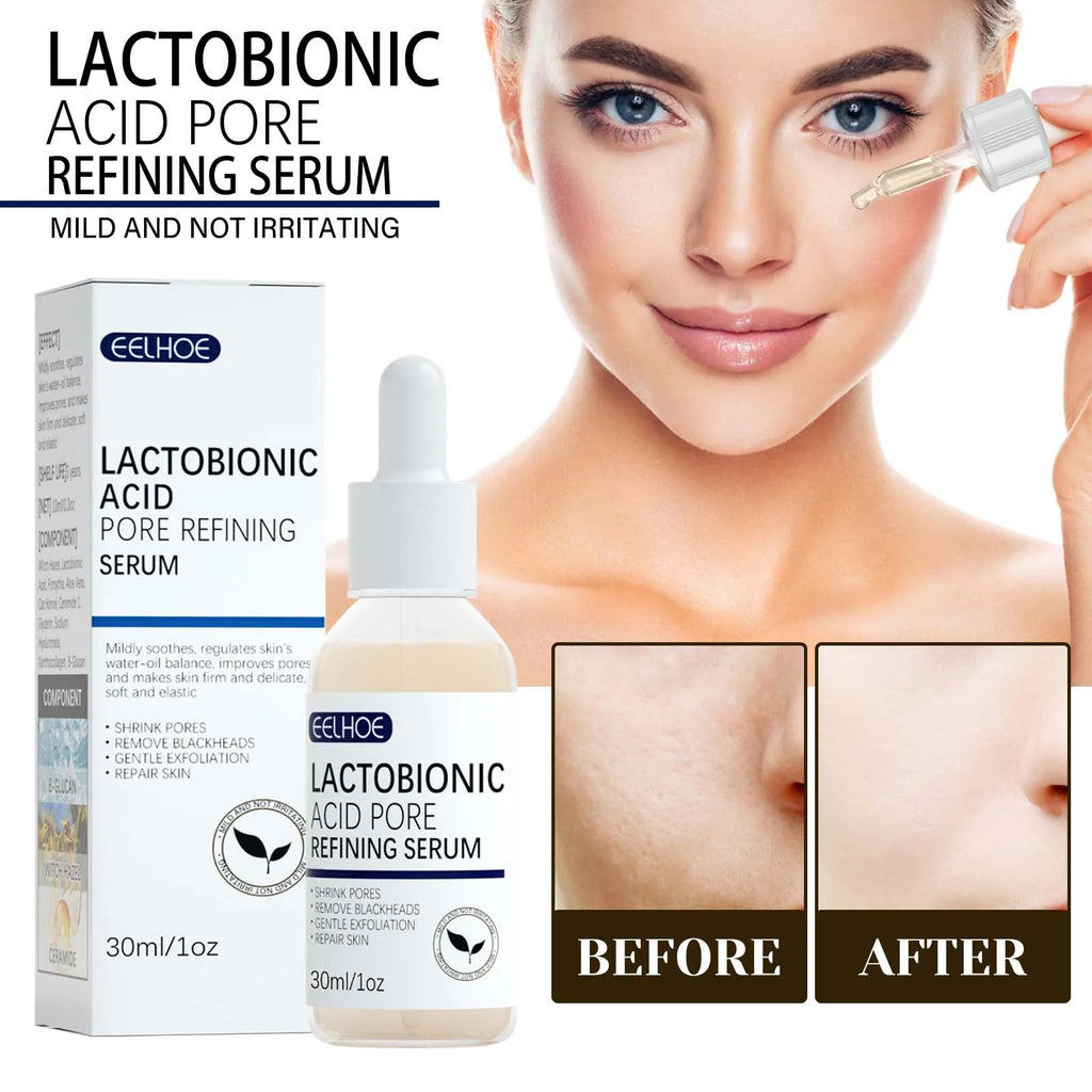 Eelhoe Lactic Acid Pore Serum – Blackhead Remover & Brightener Face Serum Zpaxo