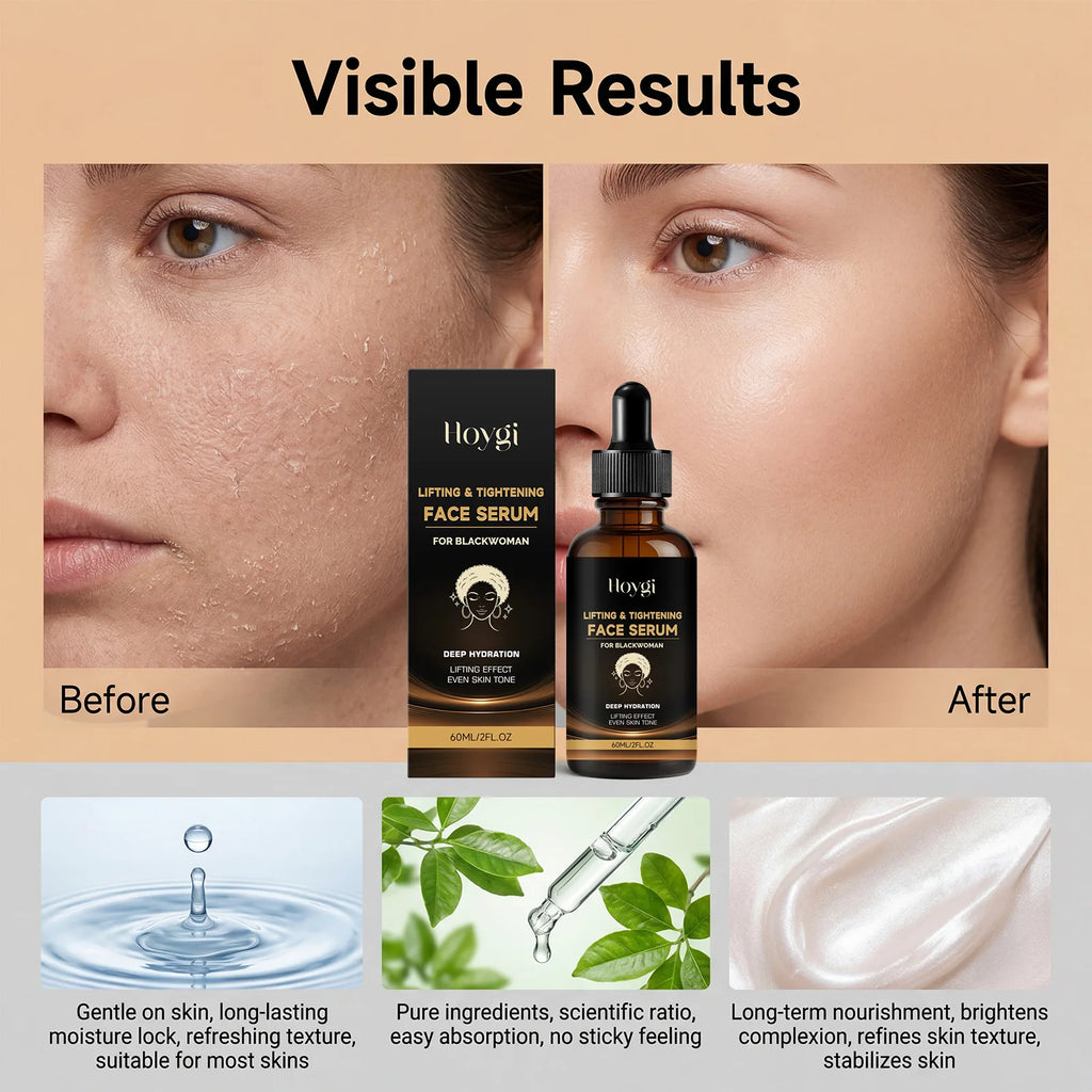 Hoygi Lifting Face Serum – Niacinamide & Hyaluronic Acid Face Serum Zpaxo