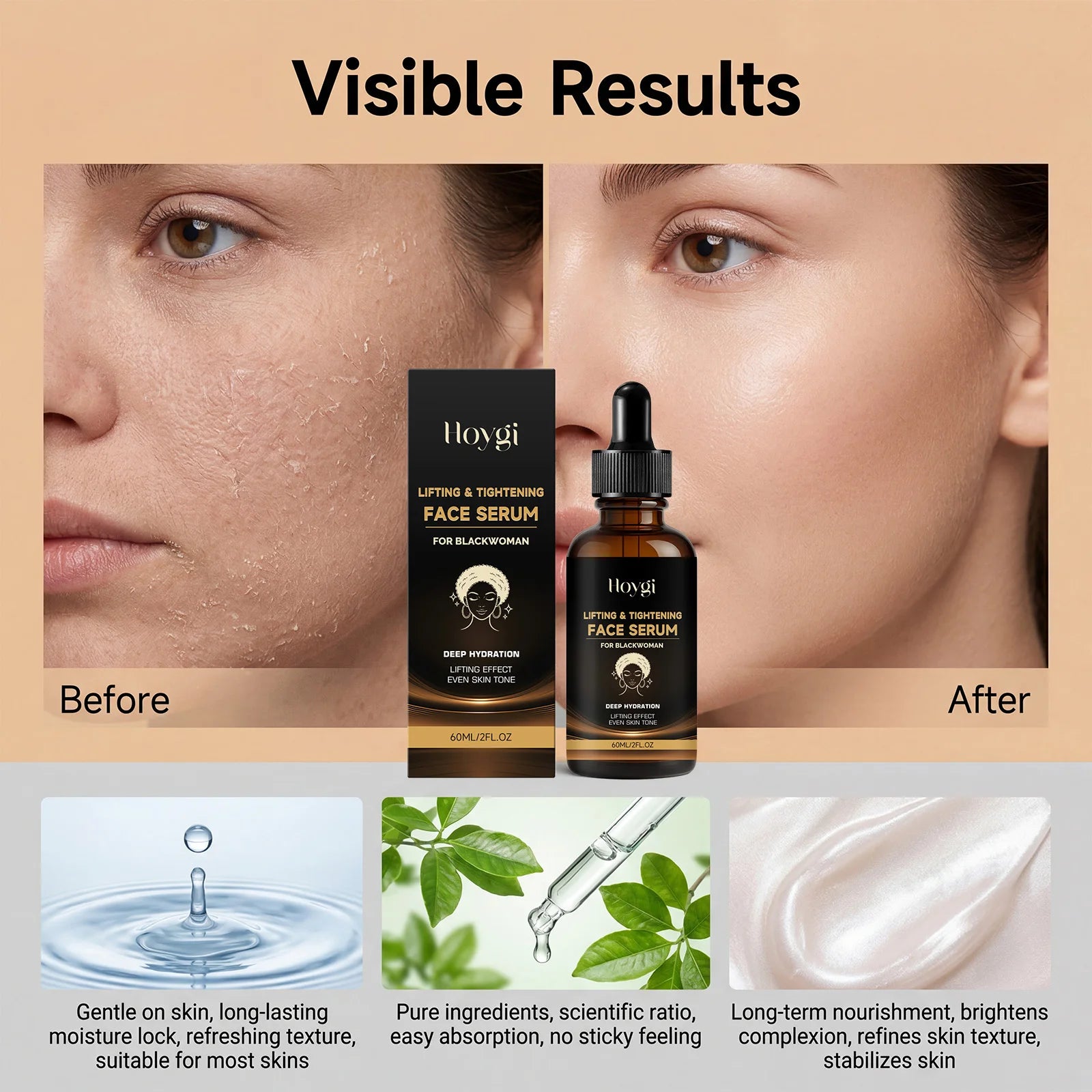 Hoygi Lifting Face Serum – Niacinamide & Hyaluronic Acid Face Serum Zpaxo