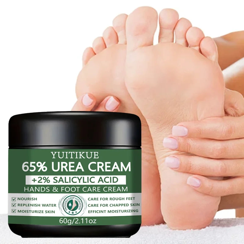 YUITIKUE 65% Urea Foot & Hand Cream – Cracked Skin Repair 60g Foot & Hand Cream Zpaxo