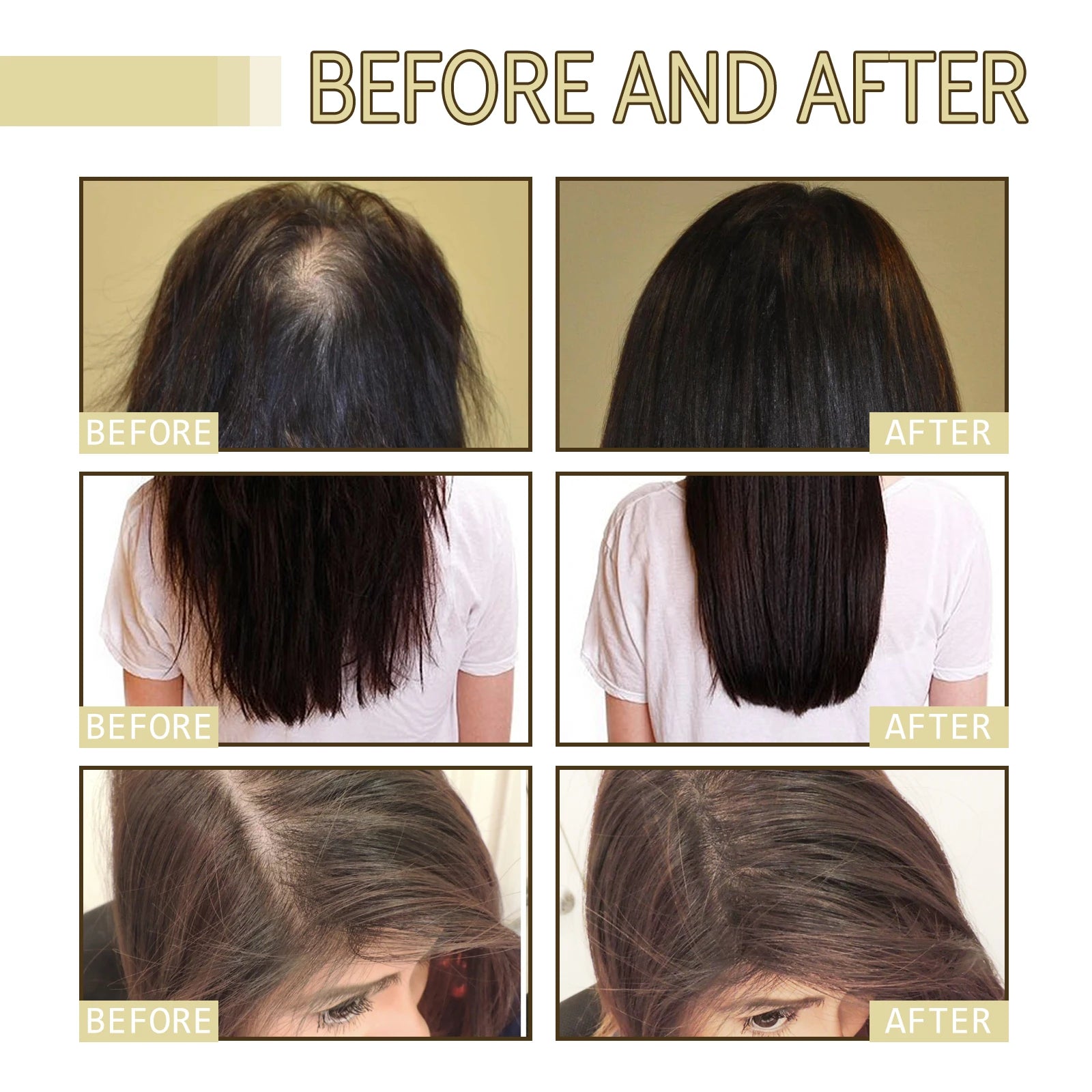 60ml Rosemary Hair Oil for Thicker Stronger Hair Growth Reduce Breakage Scalp Treatment Nourishing Hair Care for All Hair Types Zpaxo