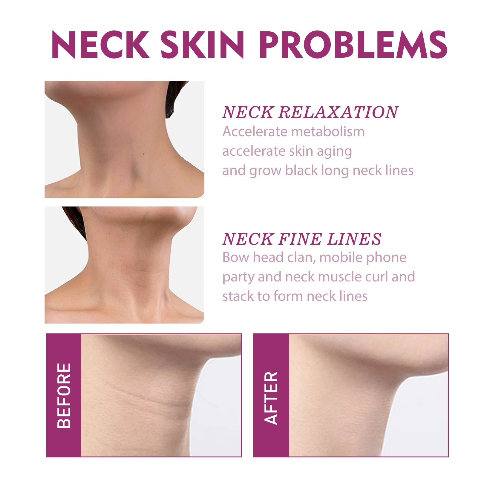 JAYSUING Hydrolyzed Collagen Neck Cream Anti-Aging Neck Firming Cream Reduce Wrinkles & Tighten Skin Moisturizing Care for neck Zpaxo