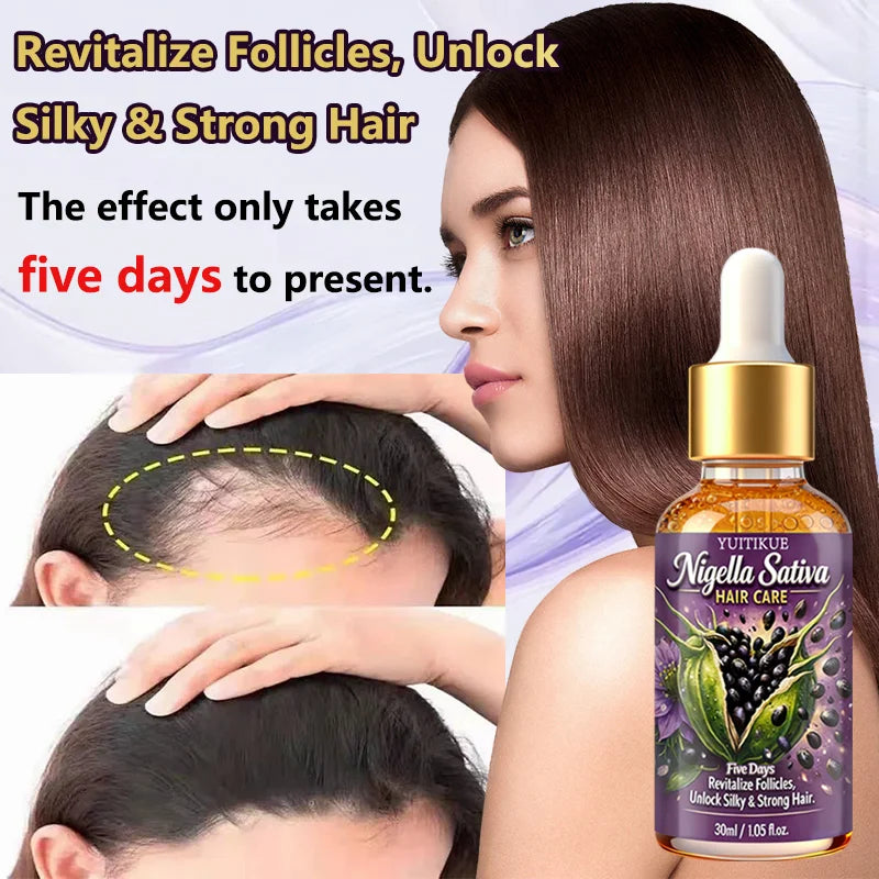 YUITIKUE Nigella Sativa Hair Oil – Nourish Scalp & Strengthen Hair Hair Treatment Oil Zpaxo