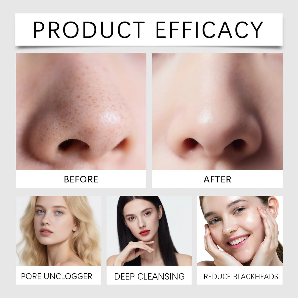 8 Pcs Gentle & Nourishing Nose Pore Strips Deep Cleansing for Sensitive Skin Oil Control & Smoothing Face Mask Winter Skincare Zpaxo