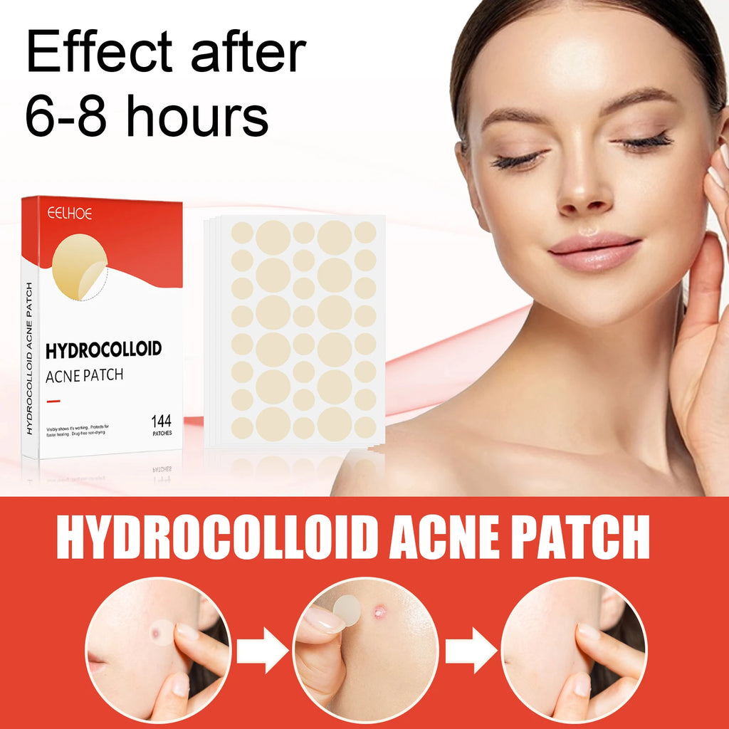 Hydrocolloid Acne Patches 144pcs | Invisible Pimple Spot Treatment Acne Pimple Patches Zpaxo