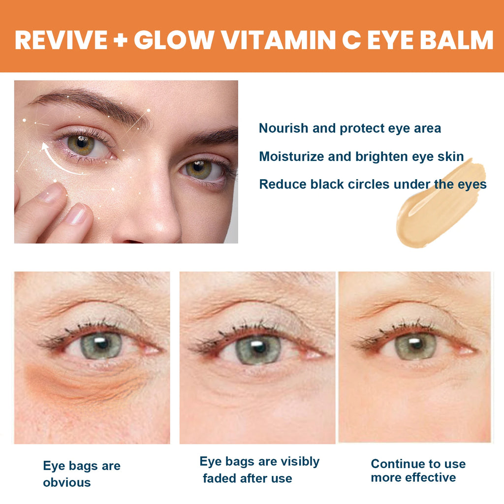 Vitamin C Eye Balm – Dark Circles, Bags & Fine Lines Eye Cream Stick Zpaxo