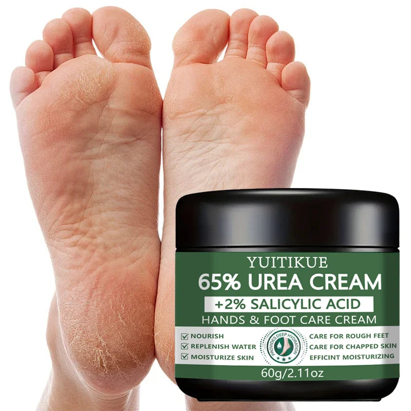 YUITIKUE 65% Urea Foot & Hand Cream – Cracked Skin Repair 60g Foot & Hand Cream Zpaxo