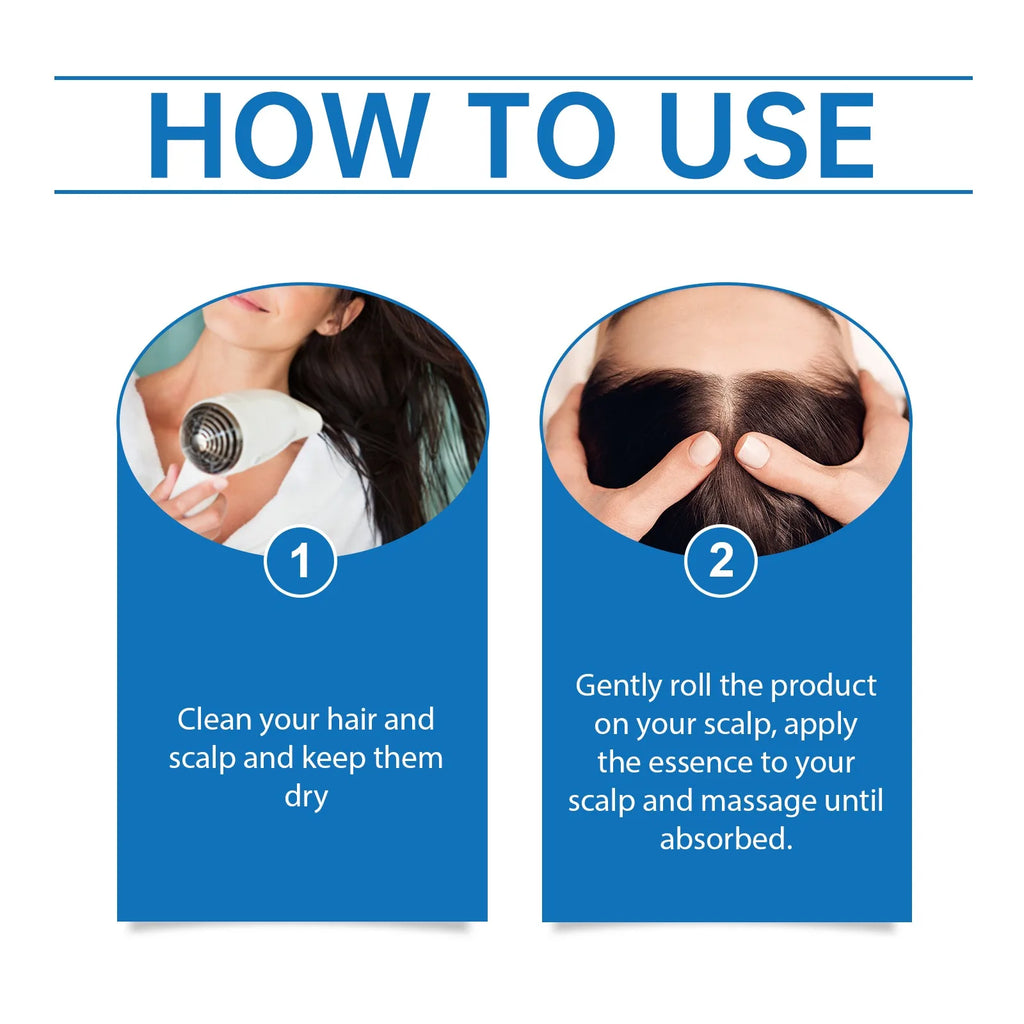 Rosemary Hair Growth Roller Serum | Scalp & Follicle Essence Hair Growth Serum Zpaxo