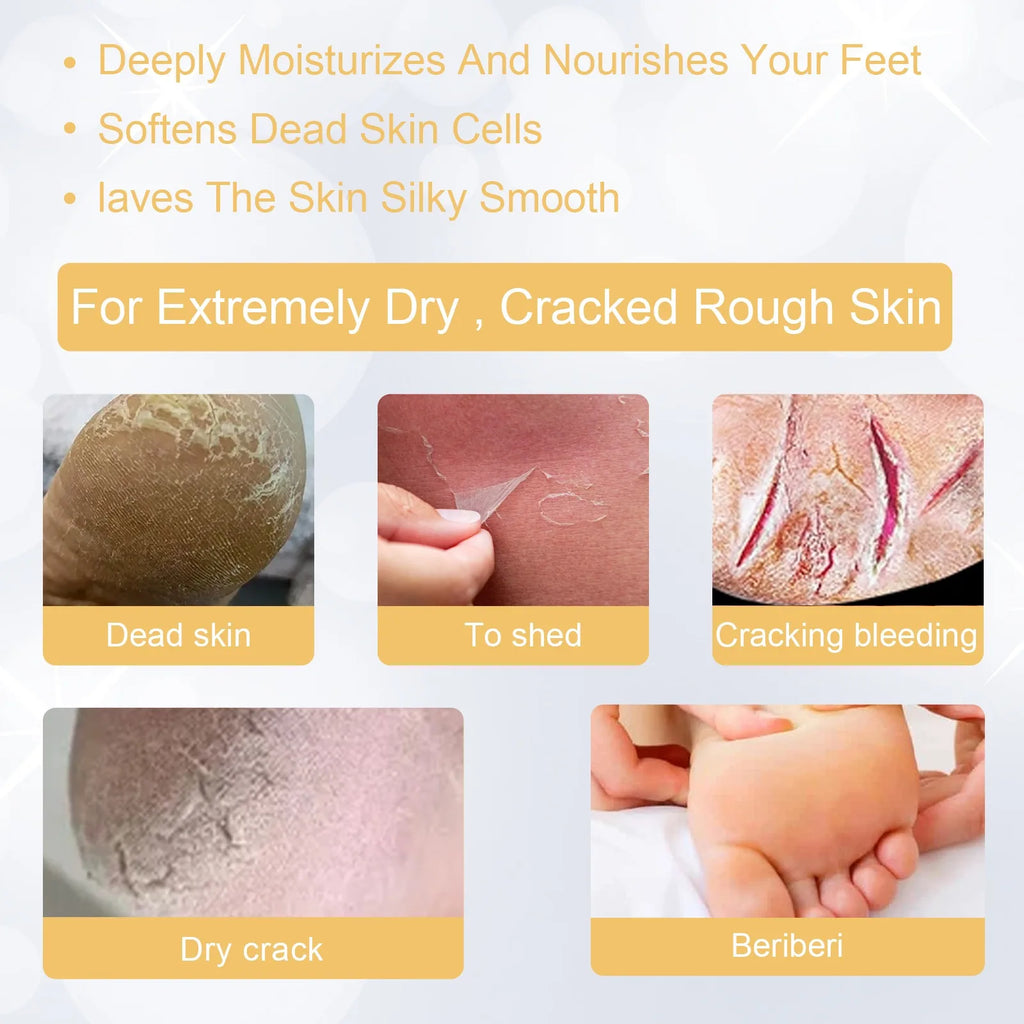 Foot Exfoliating Spray – Dead Skin, Callus & Odor Remover 200ml Foot Exfoliating Spray Zpaxo