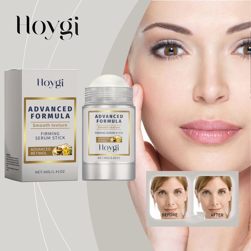 Hoygi 40g Retinol Renewal Stick Wrinkle Smoothing and Night Repair Niacinamide+Hyaluron Portable Solid Serum For Face Neck Zpaxo