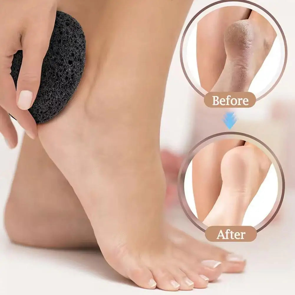 Natural Pumice Stone for Exfoliation - Unscented,Foot & Hand Foot File, Remover for Smooth Feet and Hands, Ideal for Home Use Zpaxo