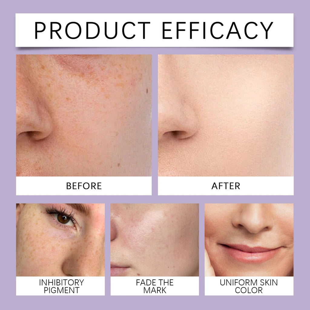 Retinol Facial Serum Hyaluronic acid Niacinamide serum Deep Hydration Lock Moisturizing Repairing Dry skin remedy Vitamin C 30ml Zpaxo