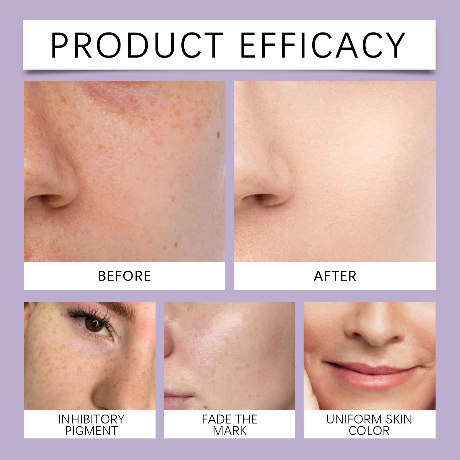 Retinol Facial Serum Hyaluronic acid Niacinamide serum Deep Hydration Lock Moisturizing Repairing Dry skin remedy Vitamin C 30ml Zpaxo