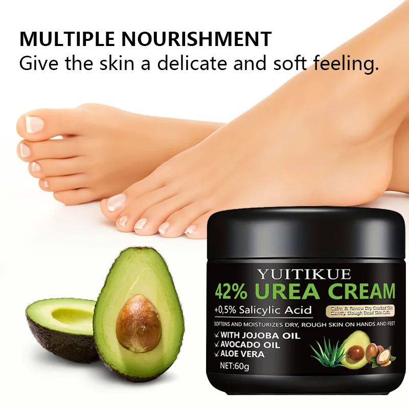 Urea Foot Cream – Repair Cracked Heels & Moisturize Dry Skin Foot Cream Zpaxo