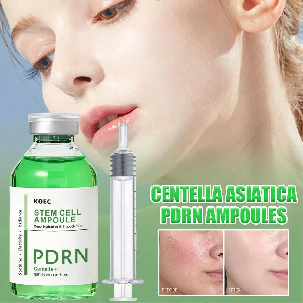PDRN Centella Ampoule Face Serum Radiance Deep Hydration Serum, Soothing & Elasticity for Smooth Skin Care 30ml Zpaxo