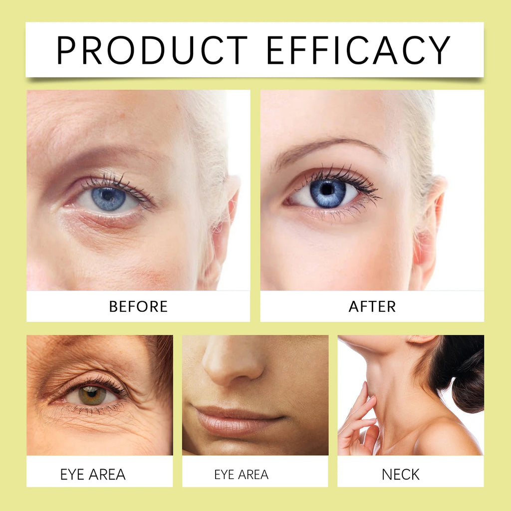 Anti-Aging Retinol Cream For Women Firming Brightening Face Moisturizer Deep Hydration Night Cream For Dry Sensitive Skin Winter Zpaxo