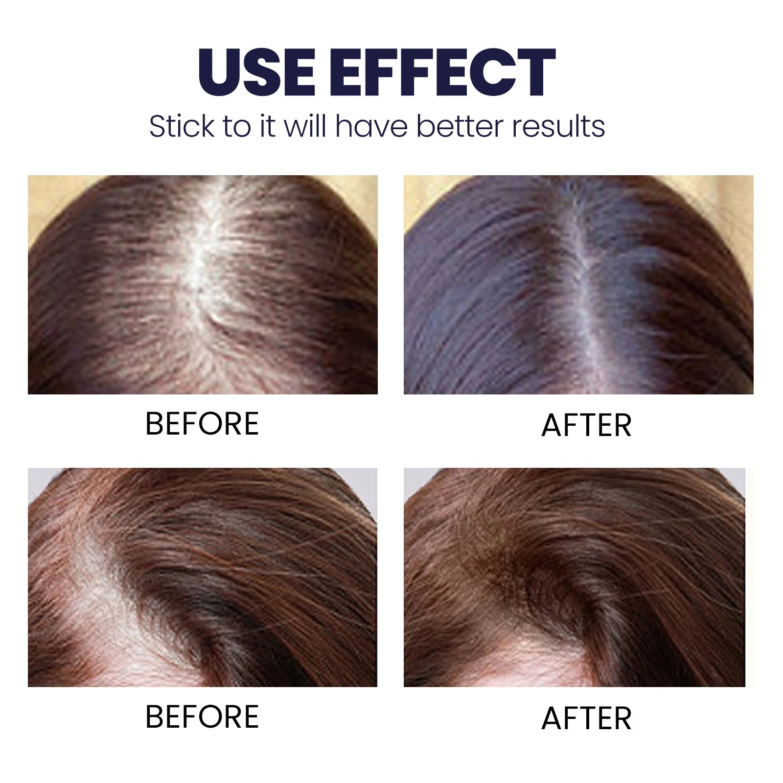 Ouhoe Hair Growth Spray Thinning Strengthen Roots Repair Dry Frizzy Collagen Formula No Residue 50ml Gentle for Sensitive Scalp Zpaxo