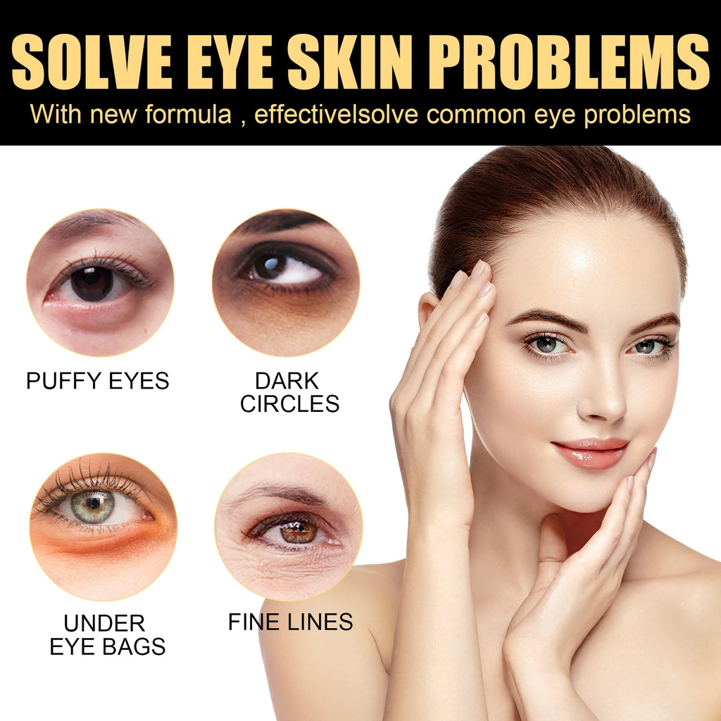 Eelhoe Firming Eye Cream – Dark Circles & Bags 15ml Eye Firming Cream Zpaxo