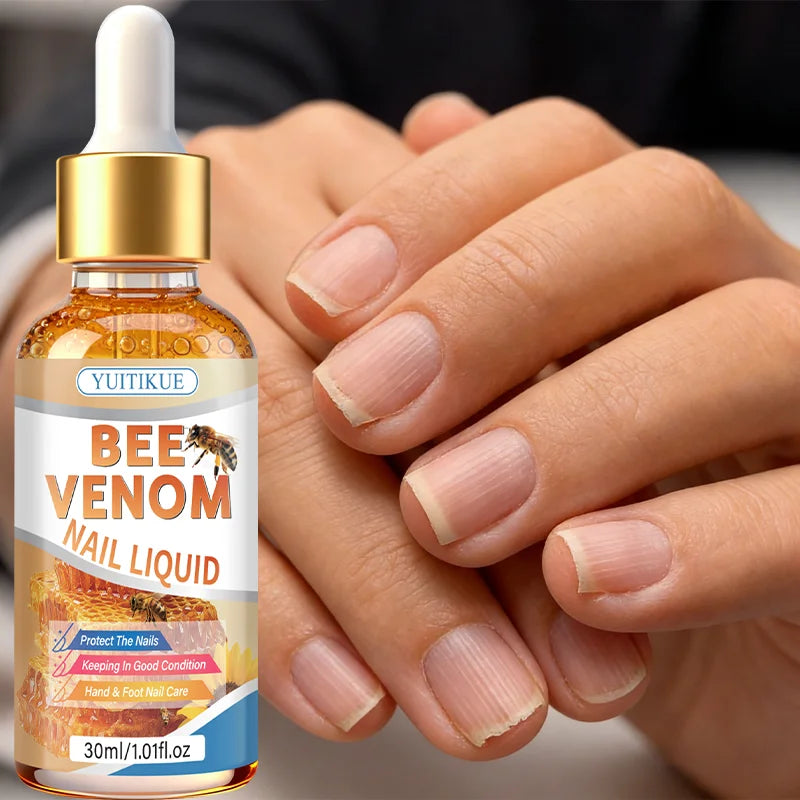 Bee Venom Nail Treatment Liquid – Moisturize & Protect Nails 30ml Nail Treatment Oil Zpaxo