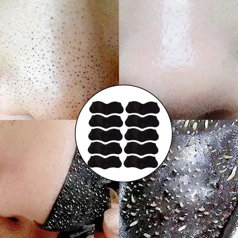Blackhead Remover Nose Strips – Pore Cleansing Patches 10/40/100