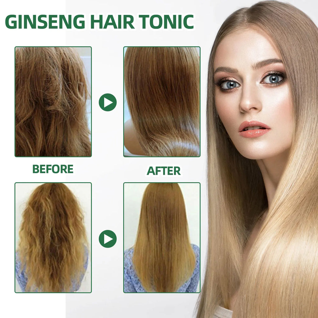 Ouhoe Ginseng Hair Growth Serum 100ml Nourish Scalp Bioactive Formula Promote Hair Regrowth Reduce Hair Fall Strengthen Roots Zpaxo