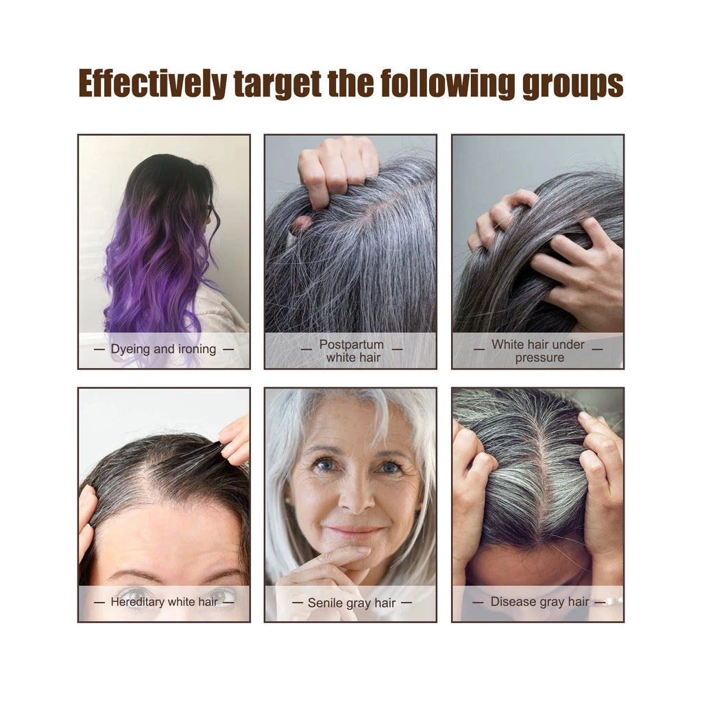Jaysuing Anti-Grey Hair Serum – Nourishing Essence Oil 30ml Hair Care Serum Zpaxo