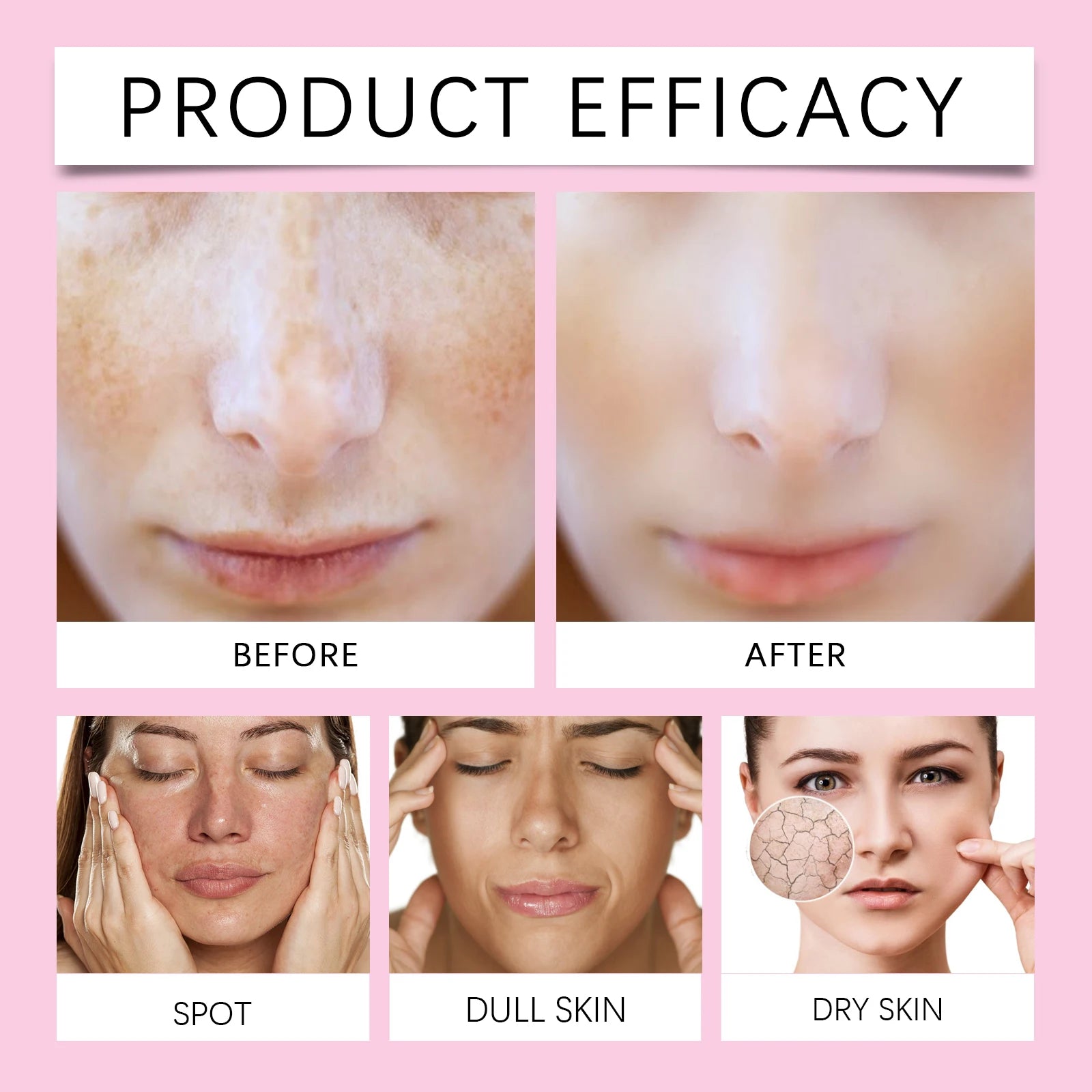 Kojic Acid Moisturizer 50g Brightening Cream Hydration Barrier Repair Face Cream for Dry Skin Winter Skincare Holiday Gift Set Zpaxo
