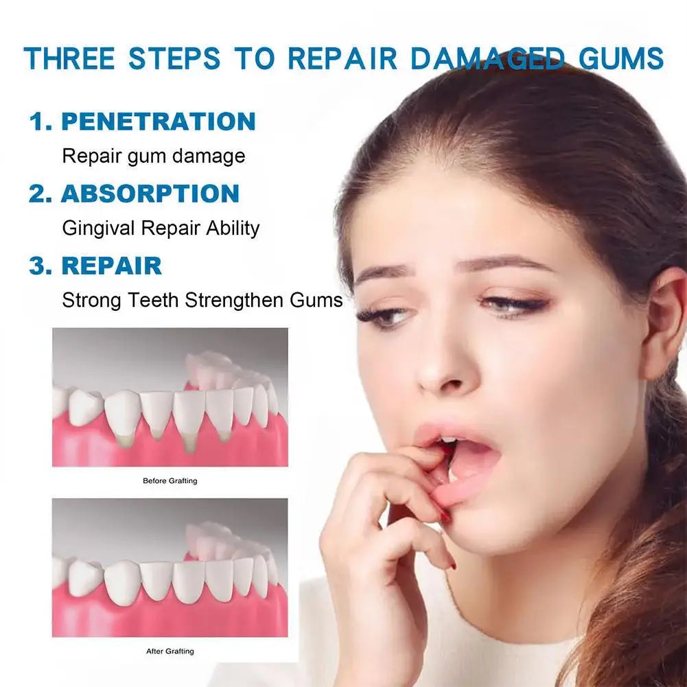 30ml Gum Repair Drops – Sore Gum Relief & Teeth Cleaning Gum Repair Serum Zpaxo