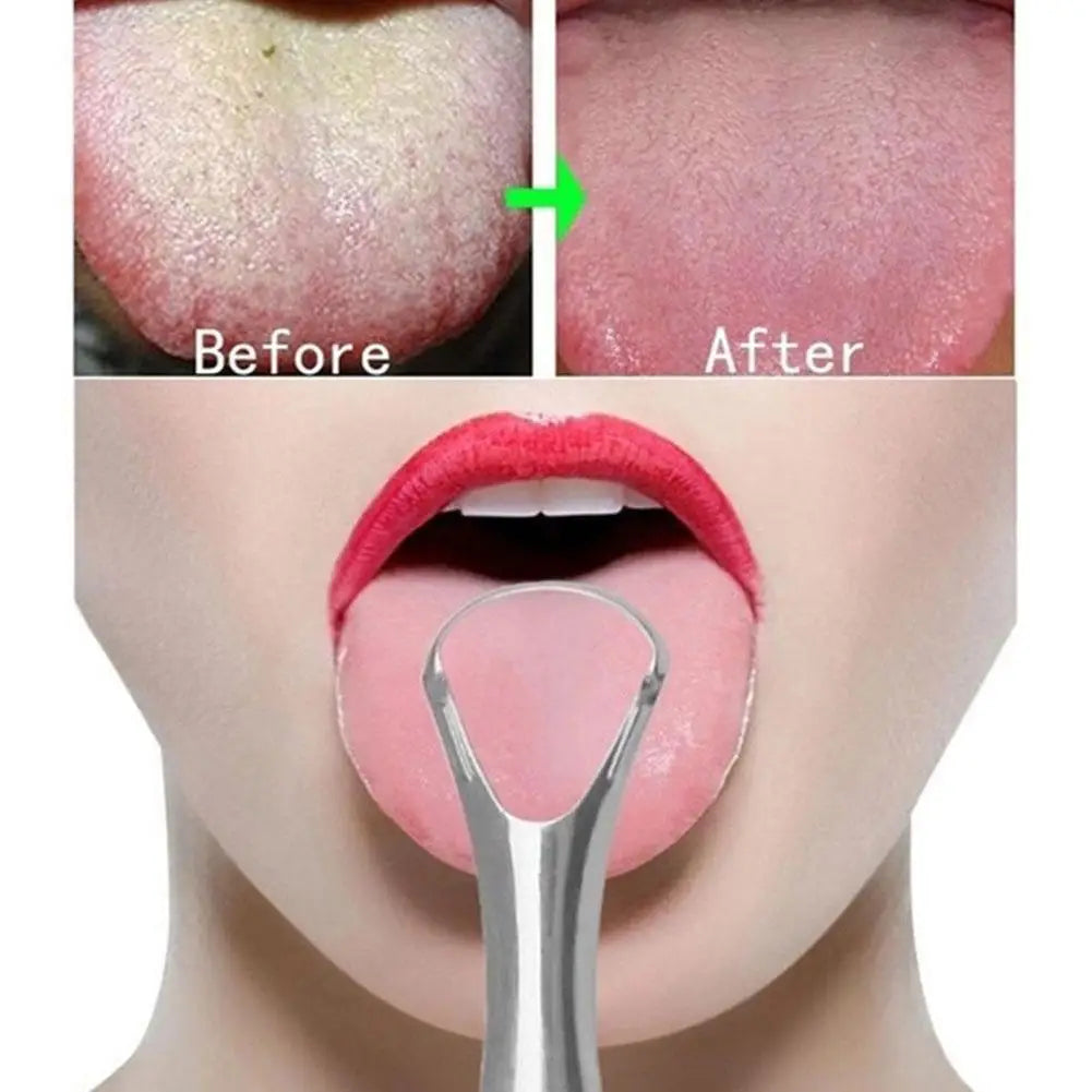 Clean Tongue Scraper Tongue Remover Halitosis Tongue Coating Oral Care Tongue Scraping Brush Stainless Steel Oral Cleaner Tools Zpaxo