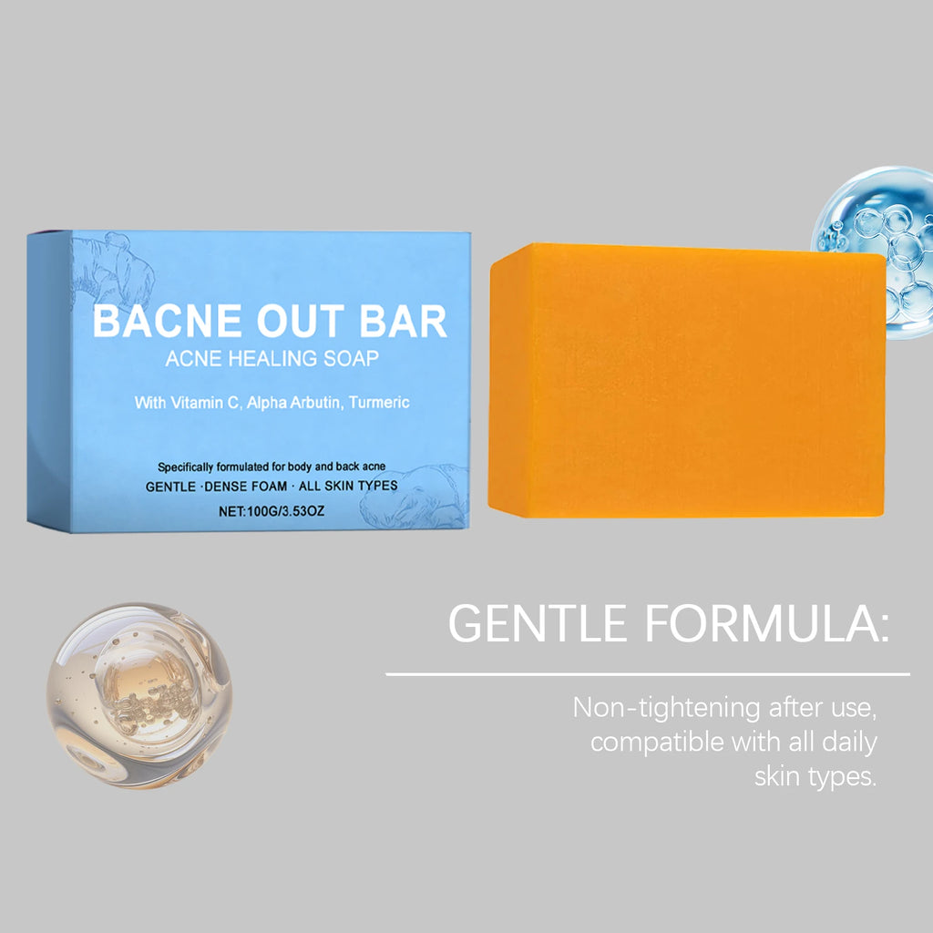 Natural Turmeric Soap Bar for Acne with Vitamin C Alphaarbutin,Acne Treatment Bar Soap Exfoliating Cleanser for Body Face Care Zpaxo