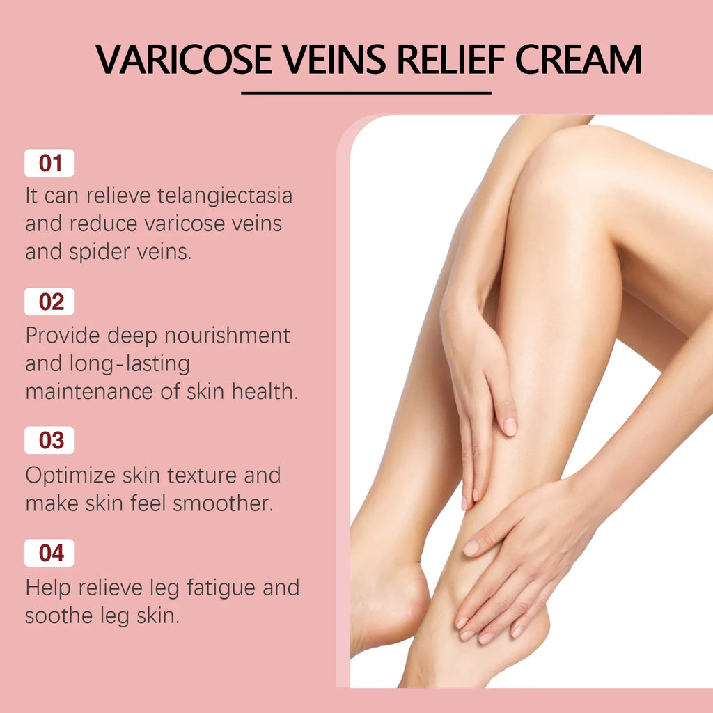 Ximonth Varicose Vein Relief Cream – Leg Swelling & Circulation Leg Relief Cream Zpaxo