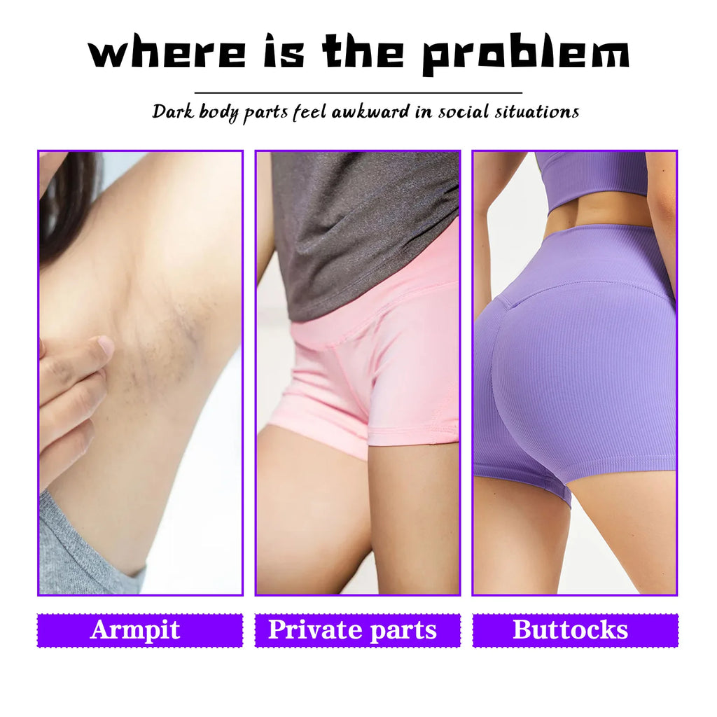 Private Parts Whitening Cream – Dark Spot & Melanin Removal Body Whitening Cream Zpaxo