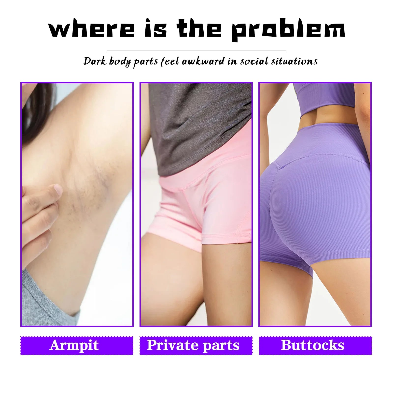 Private Parts Whitening Cream – Dark Spot & Melanin Removal Body Whitening Cream Zpaxo
