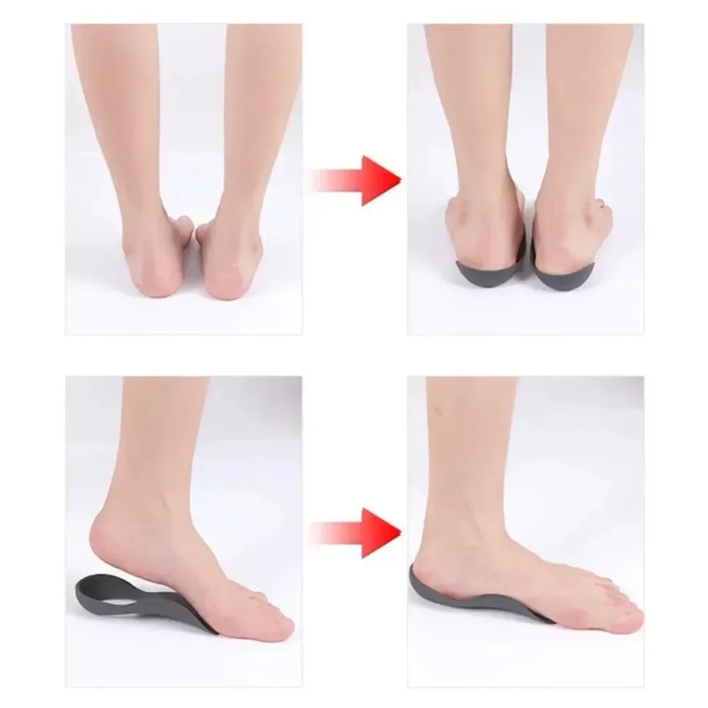 1 Pair Orthotic Insoles For Flat Feet O-Shaped Legs And Plantar Fasciitis - Unisex Arch Support Shoe Inserts Zpaxo