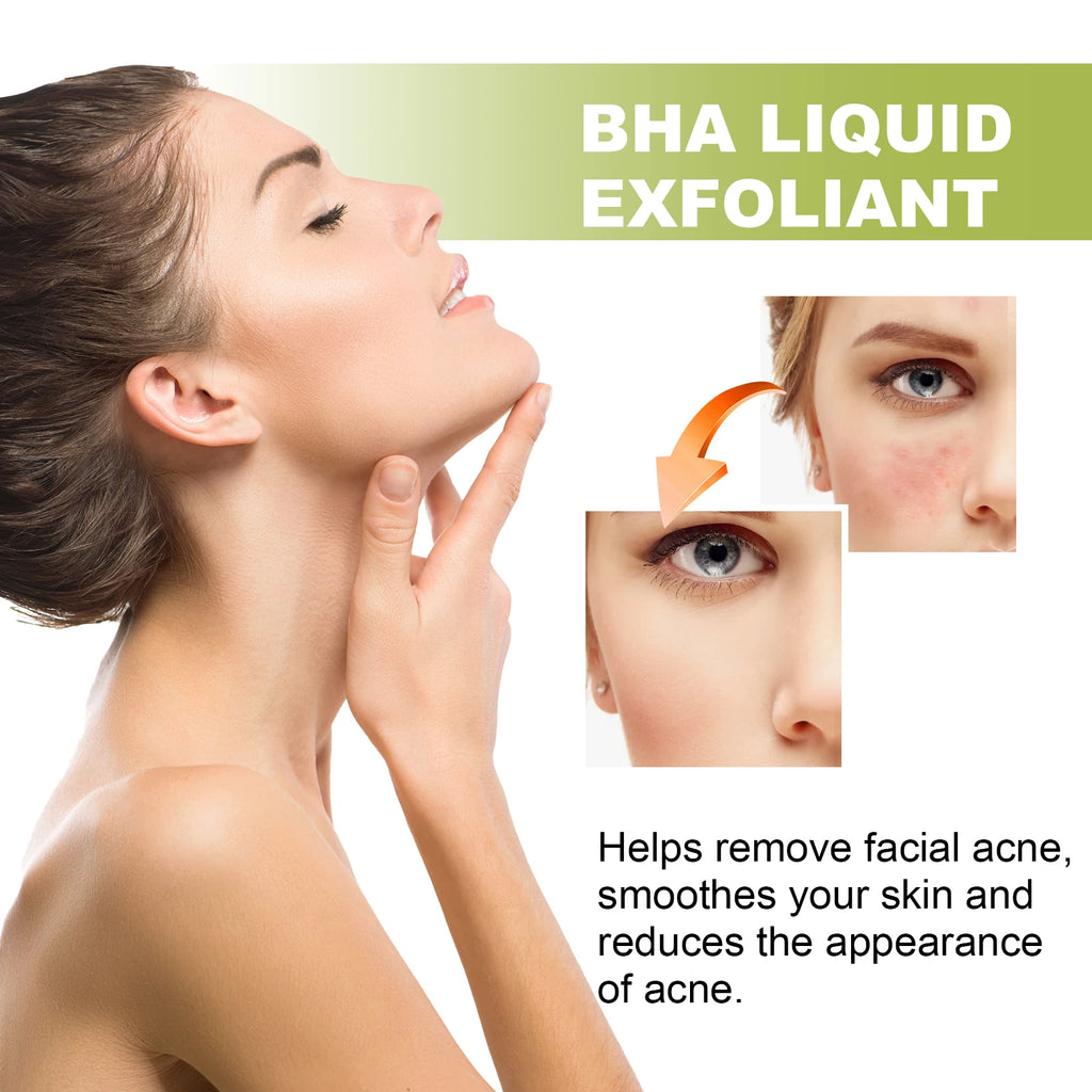EELHOE Tea Tree Anti-Acne Serum – Pore Shrinking & Brightening Anti-Acne Face Serum Zpaxo