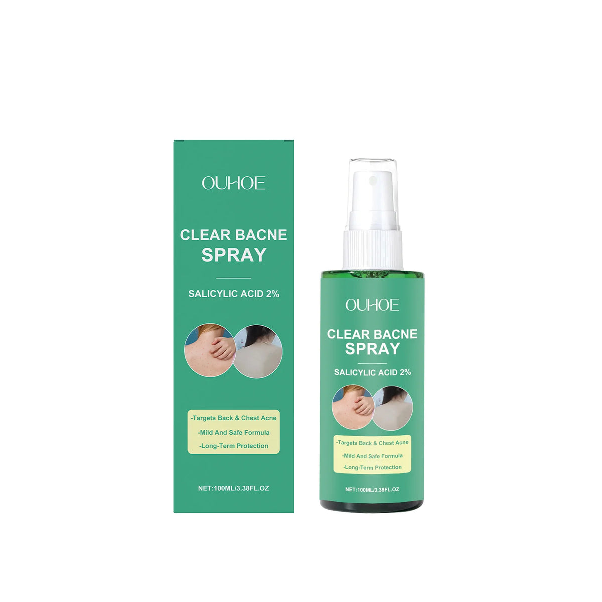 Back Acne Treatment Spray Anti Marks Spot Moisturizing Repairing Soothe Oil Control Shoulder Breast Body Pimples Remover Spray Zpaxo 100ml