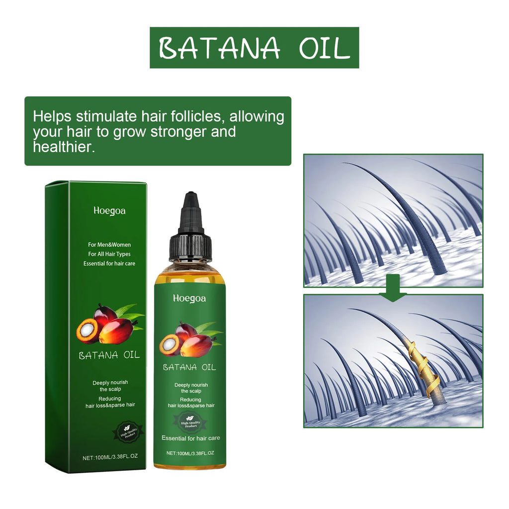 HOEGOA Hair Growth Oil – Scalp Nourishing & Frizz Control Hair Growth Oil Zpaxo