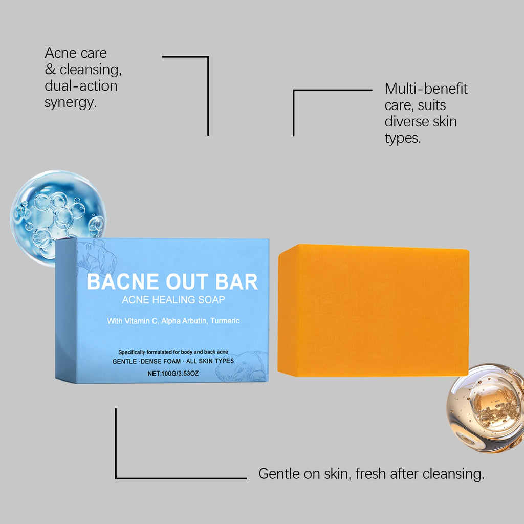 Natural Turmeric Soap Bar for Acne with Vitamin C Alphaarbutin,Acne Treatment Bar Soap Exfoliating Cleanser for Body Face Care Zpaxo