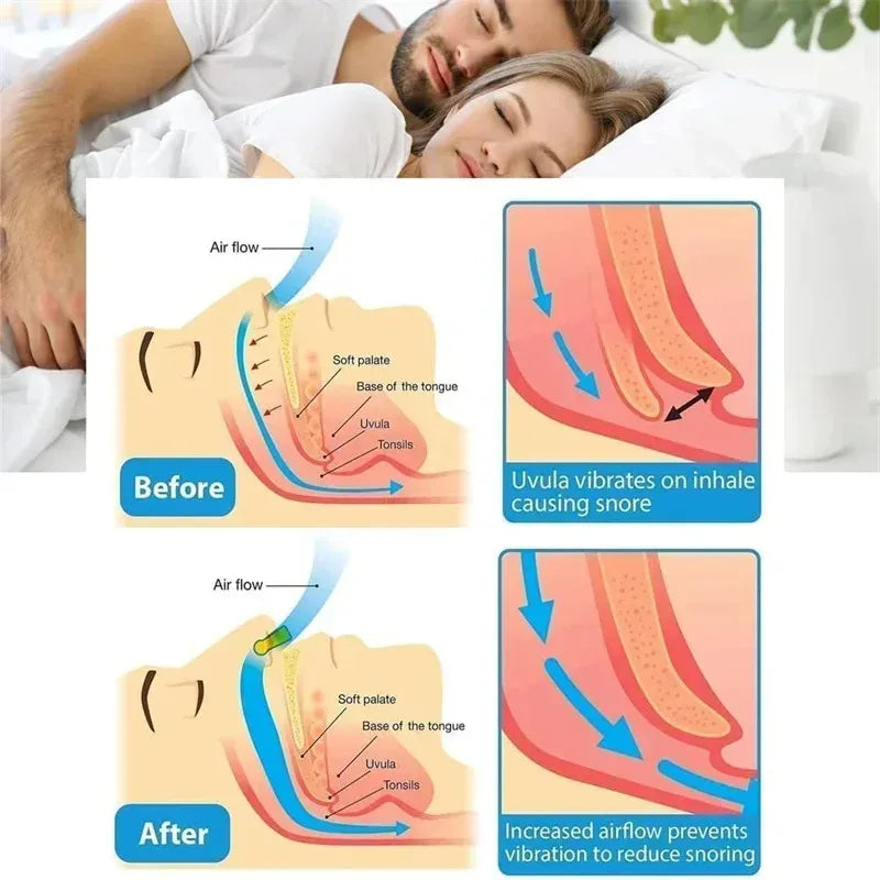 Silicone Nasal Breathing Clip – Portable Sleep Aid Nose Clip
