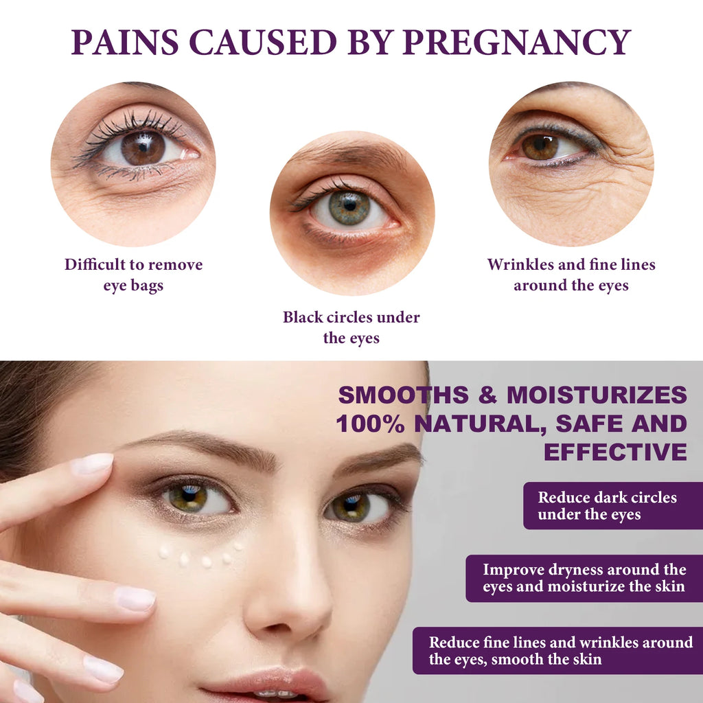 Hoygi Eye Cream – Bags, Dark Circles & Fine Lines Anti-Aging Eye Cream Zpaxo