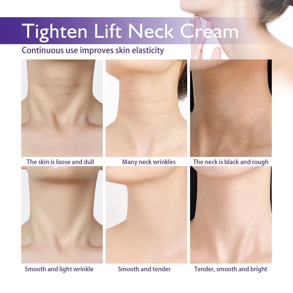 Neck Firming Cream 50g Tightening Lifting Wrinkle Reduction for Crepey Skin Intensely Hydrating Nourishing Cream with Shea Butte Zpaxo