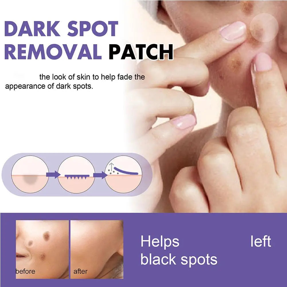 Eelhoe Invisible Acne Patches – Face Spot Stickers 144pcs Acne Spot Patches Zpaxo