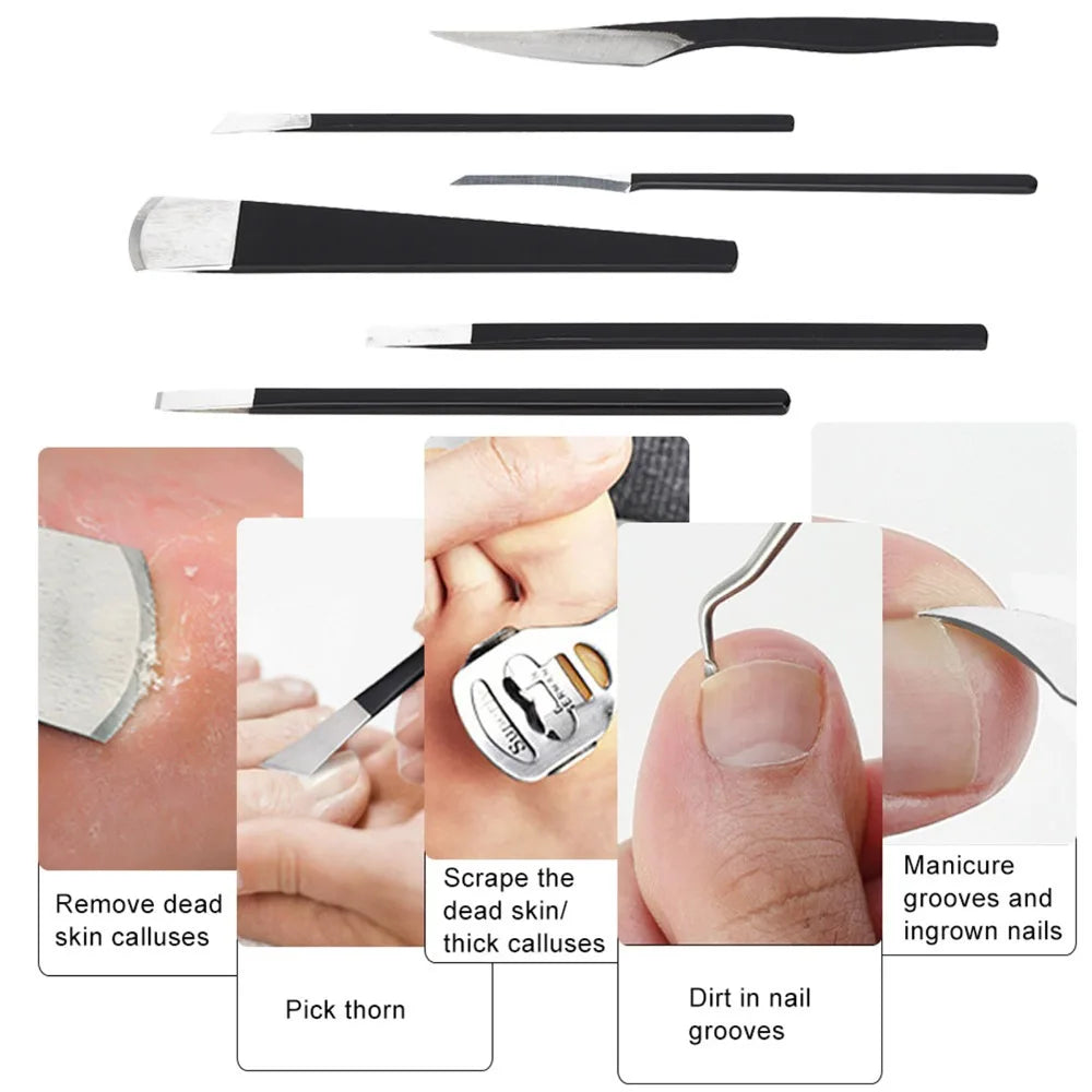 Stainless Steel Foot Care Repair Tools Non Slip Handle Sharp Blade Zpaxo
