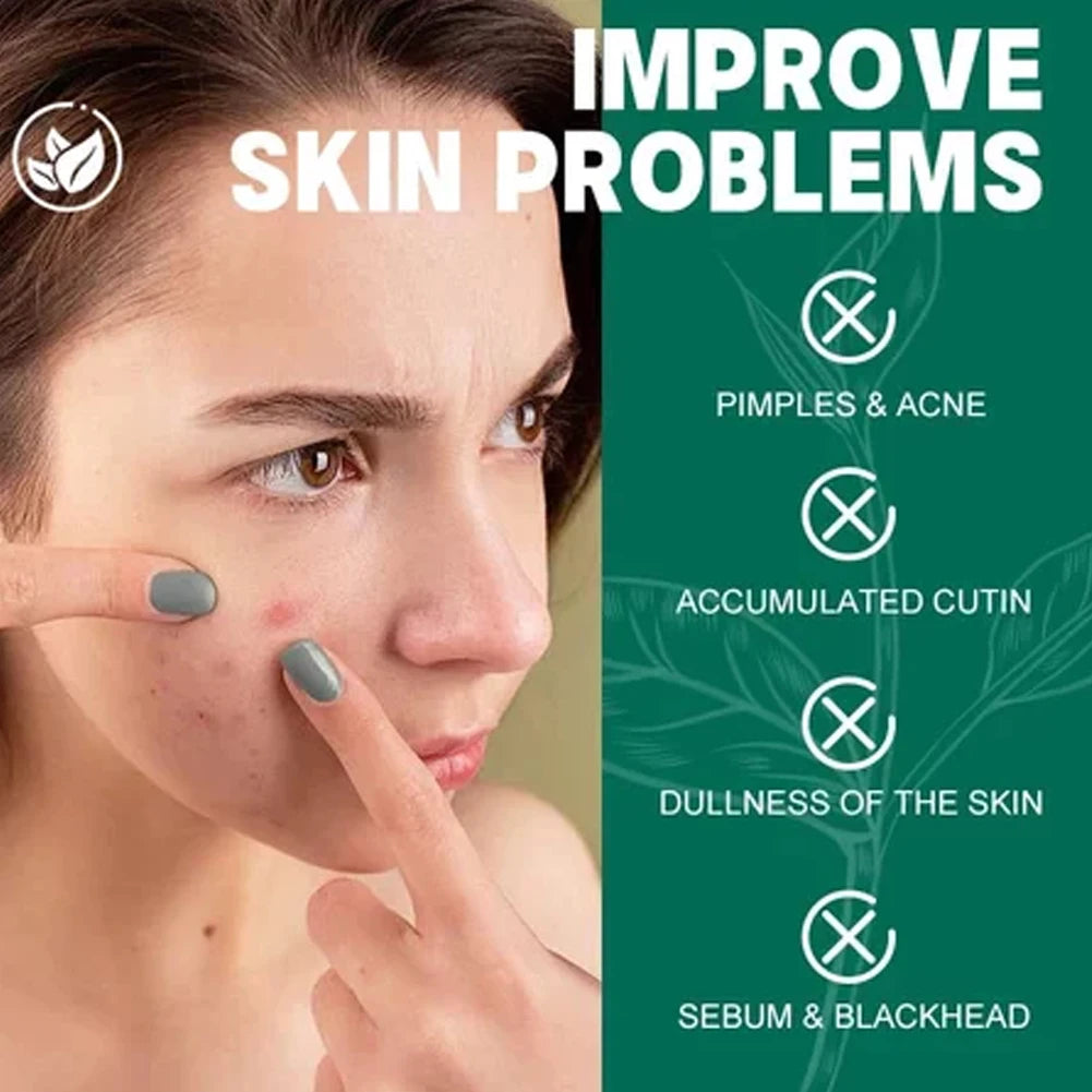 SOME BY MI Korean Skincare Set for Oily Acne-Prone Skin Korean Skincare Set Zpaxo